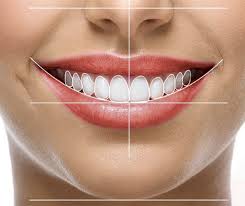 Dise;o de Sonrisa 